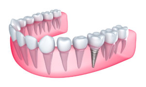 Norwell Pediatric Dentistry South Shore adult dentistry